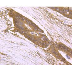 Anti-DDIT4 antibody