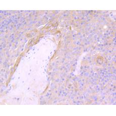 Anti-NLRC3 antibody