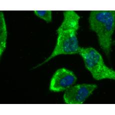 Anti-IL-8 antibody