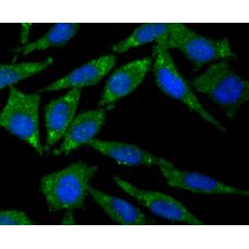 Anti-CD21 antibody