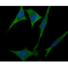 Anti-ULK1 antibody