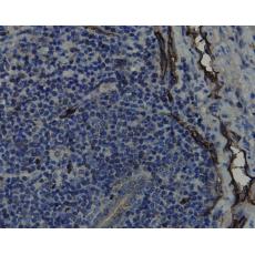 Anti-CD34 antibody