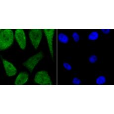 Anti-PKA C alpha antibody