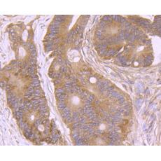 Anti-AMACR antibody