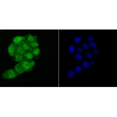 Anti-HMGB2 antibody