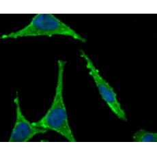 Anti-CD4 antibody
