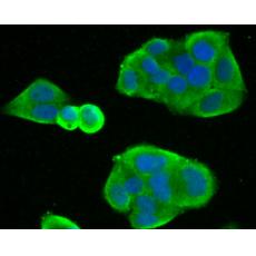 Anti-FAP antibody
