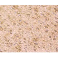 Anti-TrkA antibody