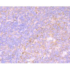 Anti-iNOS antibody