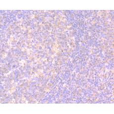 Anti-IL-17 antibody