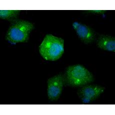 Anti-Smad4 antibody