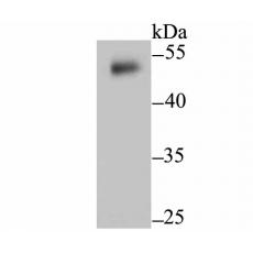 Anti-Cytokeratin 8 antibody
