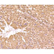 Anti-RAR alpha antibody
