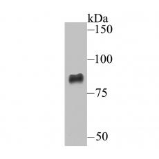 Anti-ADAM10 antibody