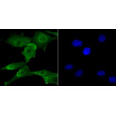 Anti-VEGF Receptor 2 antibody
