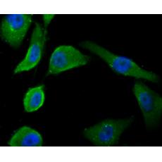 Anti-PSMA antibody