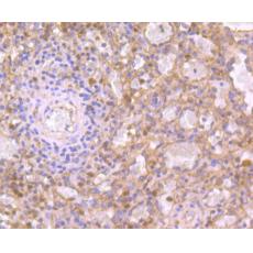 Anti-IL19 antibody