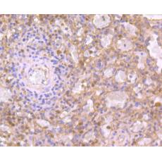 Anti-IL19 antibody