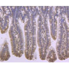 Anti-PBR antibody