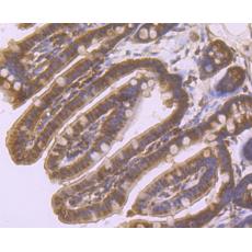 Anti-Beta-Arrestin 1 antibody