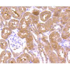 Anti-Osteopontin antibody