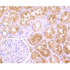 Anti-PFAS antibody