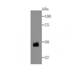 Anti-FEZF2 antibody