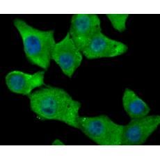 Anti-Fibrinogen antibody