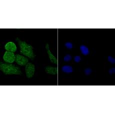 Anti-PKC beta antibody