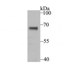 Anti-USP21 antibody