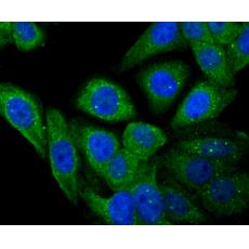Anti-Apolipoprotein A1 antibody