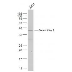 Anti-Vasohibin 1 antibody