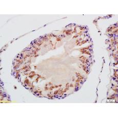 Anti-VDAC3 antibody