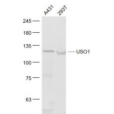 Anti-Vesicle docking protein p115 antibody