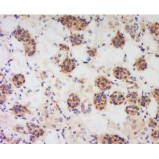 Anti-Visfatin antibody