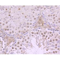 Anti-Progesterone Receptor antibody