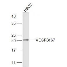 Anti-VEGFB167 antibody