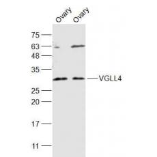 Anti-VGLL4 antibody