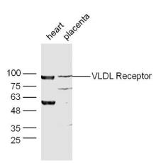 Anti-VLDL Receptor antibody