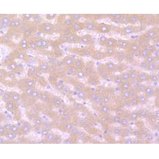 Anti-Noggin antibody