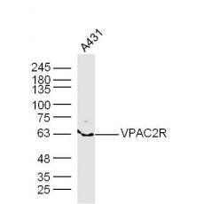 Anti-VPAC2R antibody