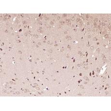 Anti-VPS4a antibody
