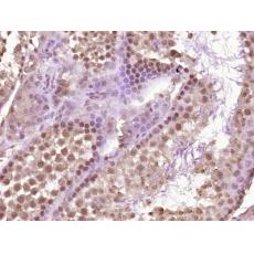 Anti-VRTN antibody