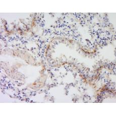 Anti-VSIG4 antibody