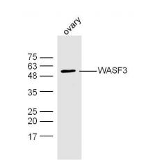 Anti-WASF3 antibody
