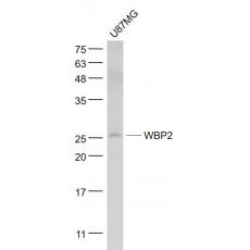 Anti-WBP2 antibody