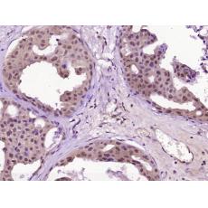 Anti-WEE1 antibody