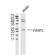 Anti-WISP2 antibody