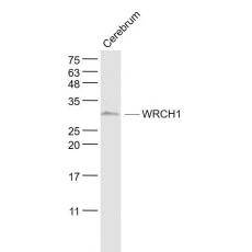 Anti-WRCH1 antibody