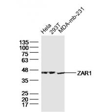 Anti-ZAR1 antibody